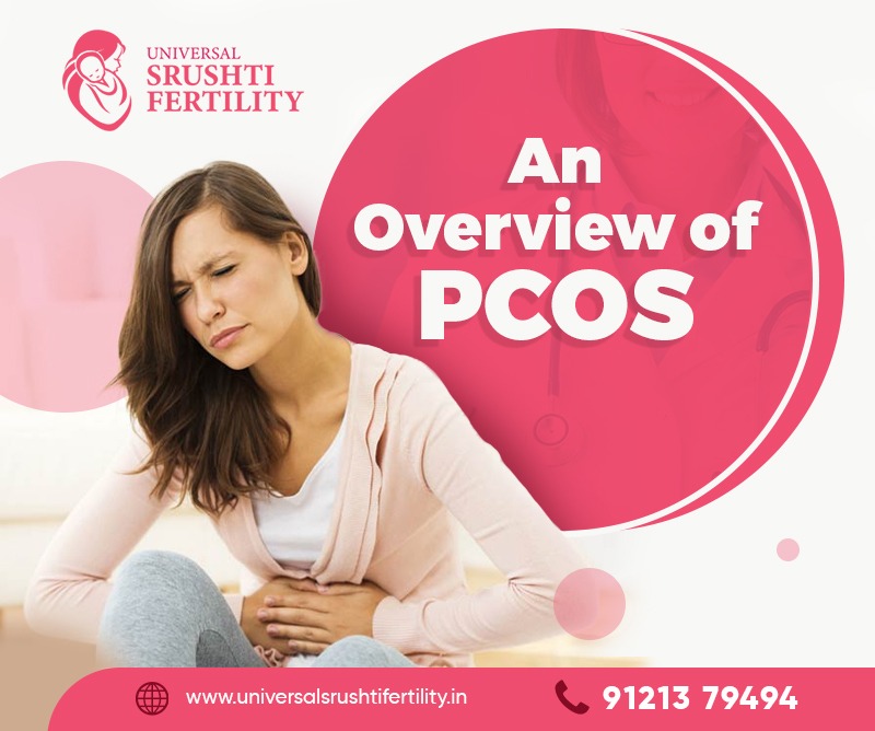 An Overview of PCOS